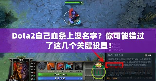 Dota2自己血條上沒(méi)名字？你可能錯(cuò)過(guò)了這幾個(gè)關(guān)鍵設(shè)置！